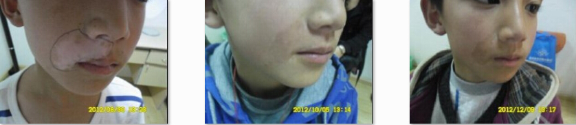 ��ͯ��������ͼƬ